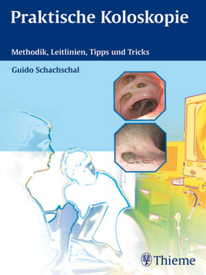 cover image of Praktische Koloskopie